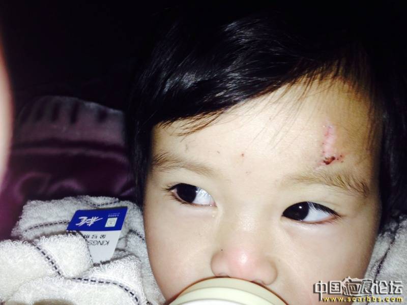 怎么没有3M减张胶带卖啊? - 3m胶带-中国疤痕