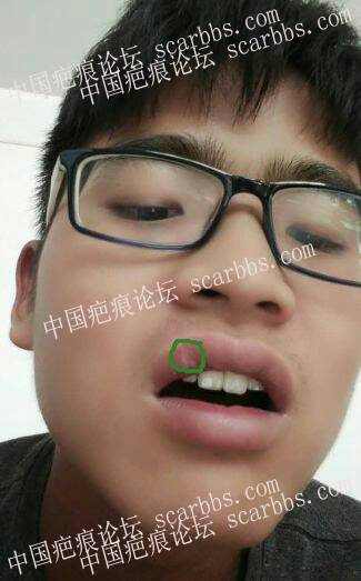 杨东运-医患交流区-重庆整形_疤痕医生_西南医