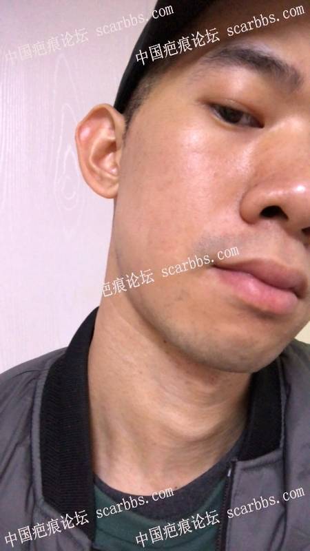 105701ptoyey1qwyfq5yw5.jpg